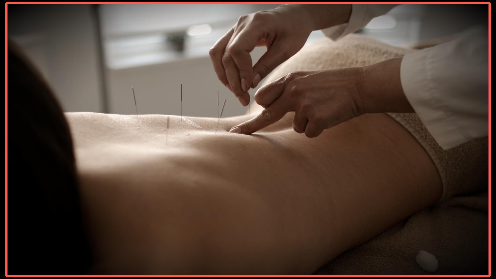 acupuncture with orange border